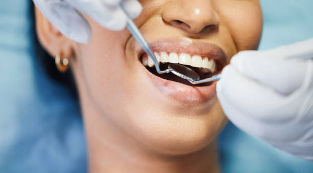 Best Cracked Tooth Emergency Dentist  in Discovery Bay, CA